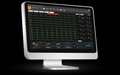 EKG SE 1515