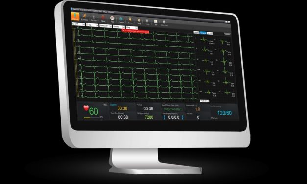 EKG SE 1515